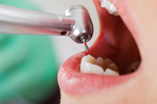 Best Emergency Denture Repair in Lone Star, TX